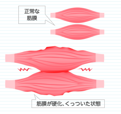 筋膜リリースガン美容/健康