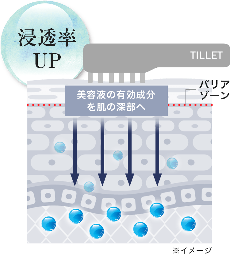 ティレットによる電気穿孔法「エレクトロポレーション」